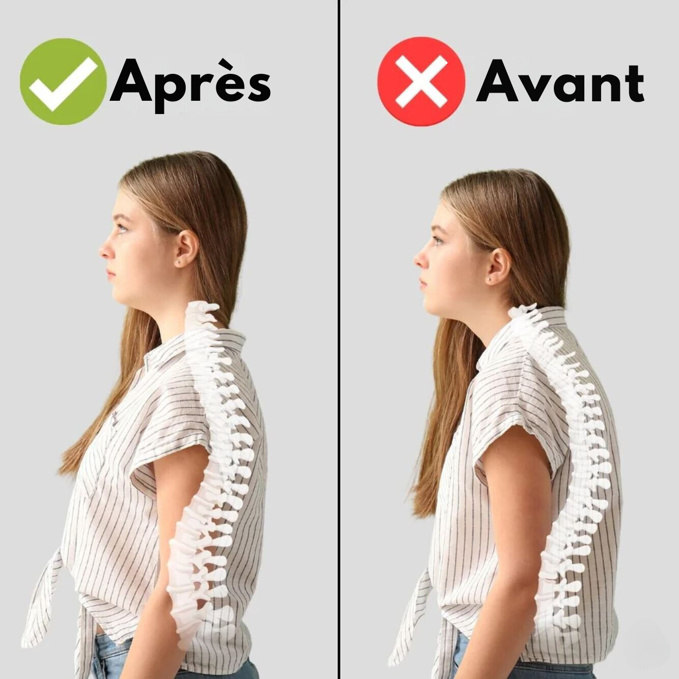 Correcteur Pro™ | Offrez-vous une posture raffinée et une élégance de mannequin en seulement quelques semaines.